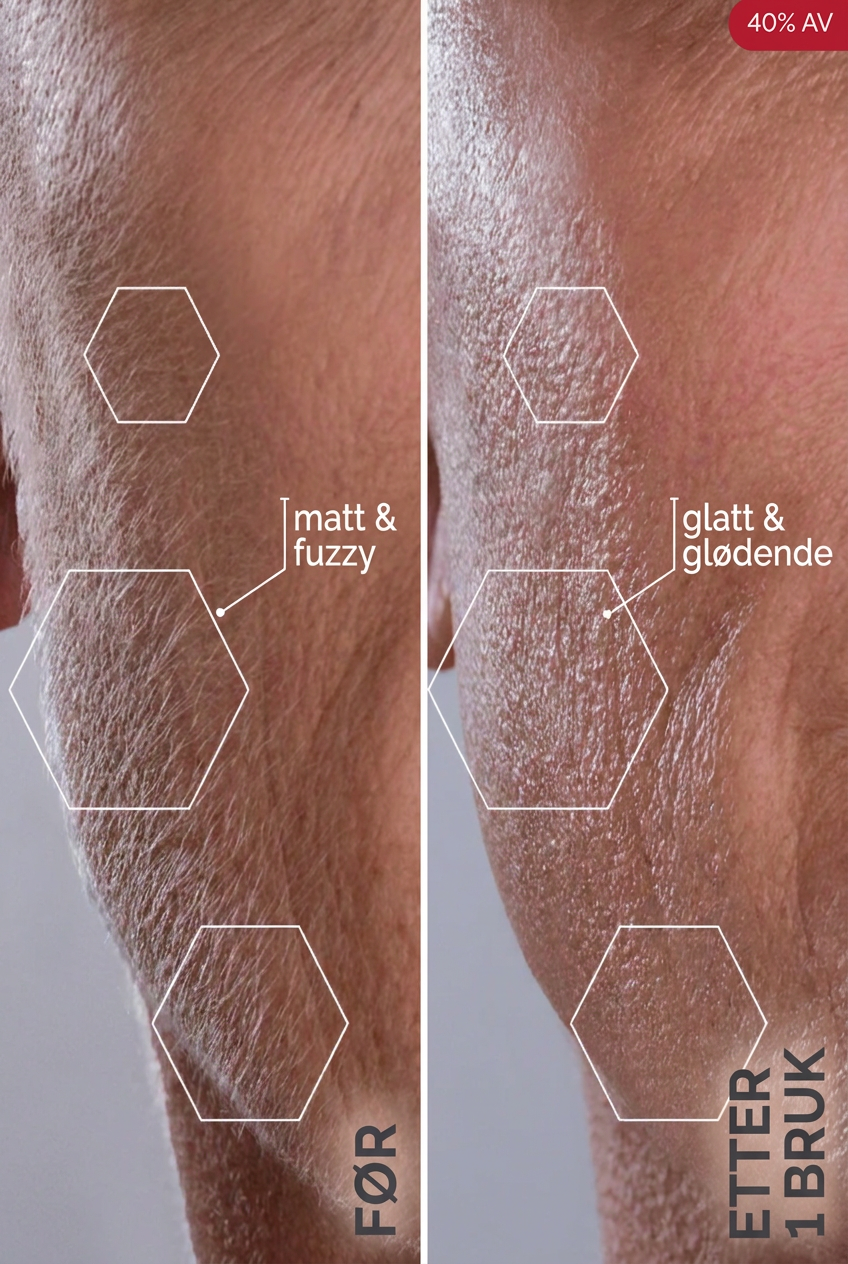 Glosskin Sonisk Dermaplaning-system