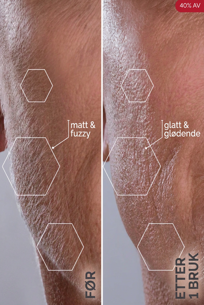 Glosskin Sonisk Dermaplaning-system