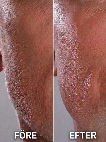 Glosskin Sonisk Dermaplaningssystem